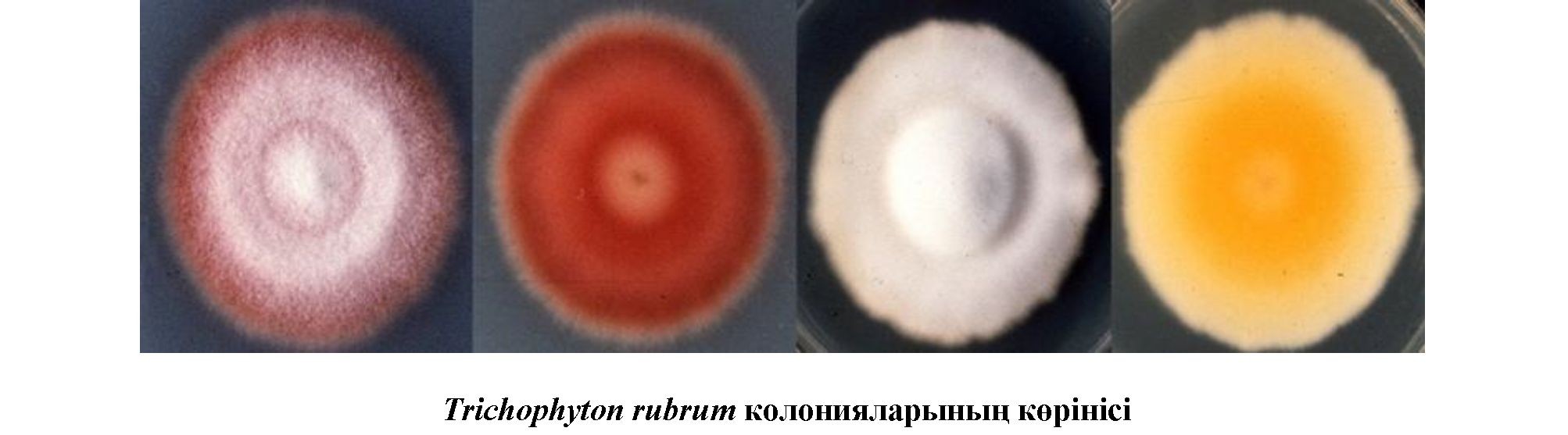 Trichophyton rubrum саңырауқұлақтарының морфо-физиологиялық ерекшеліктері