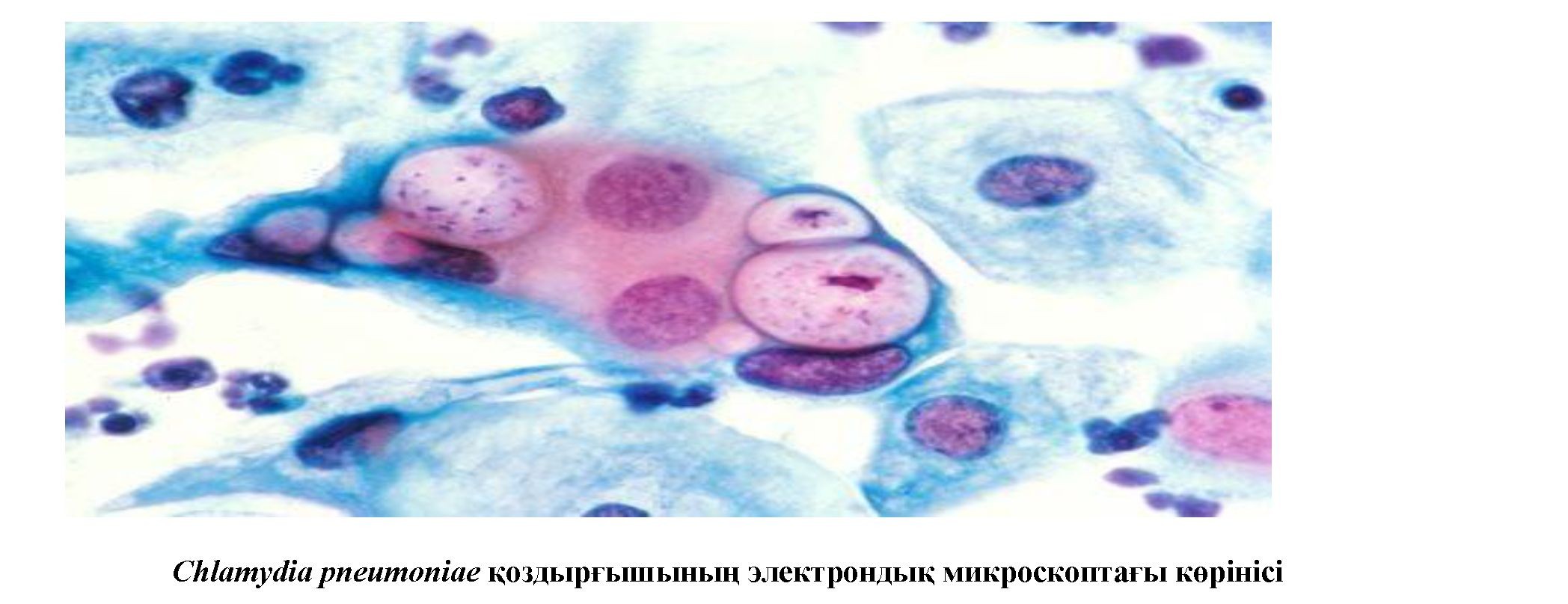 Хламидиялық пневмонияны қоздырушылардың ерекшеліктерін анықтау