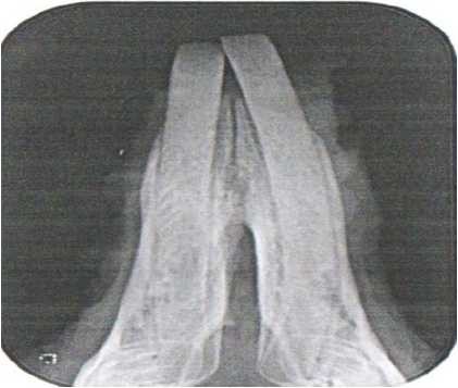 Қоянның төменгі жақ фрагментінің рентгендік көрінісі