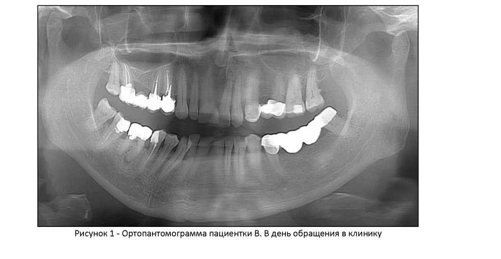 Травмы в стоматологии