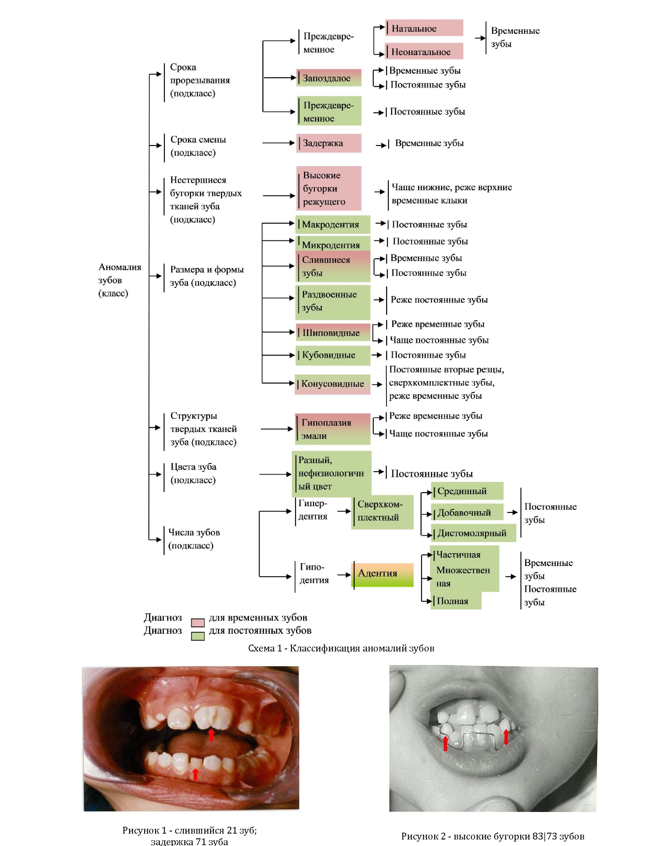 Аномалии зубов: классификация, терминология с подходом диагностики