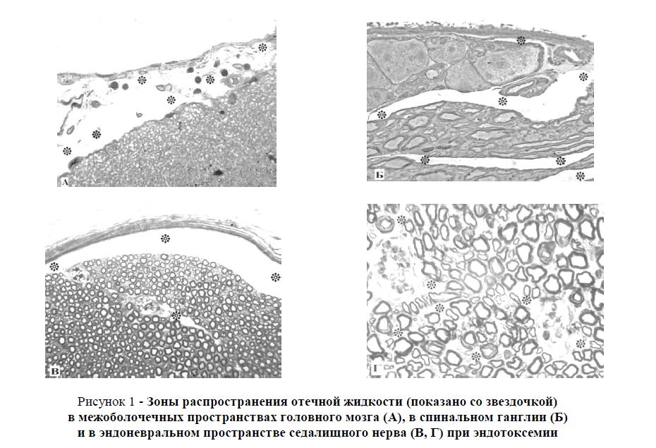 Ультраструктурные показатели участия мононуклеарных фагоцитов в формировании эндототксемического отека в коре головного мозга, спинальных ганглиях и периферических нервах